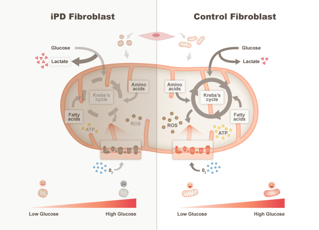 Graphical abstract describing the mitochondrial alterations observed in primary cultured fibroblasts from Idiopathic Parkinson’s disease patients.