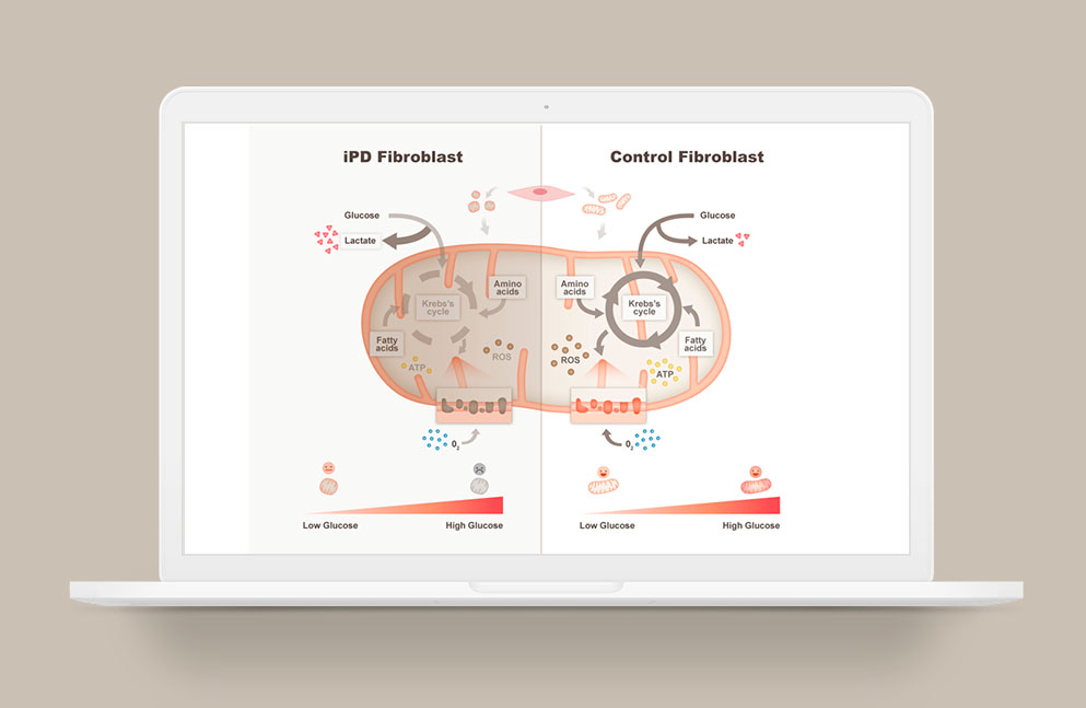 Graphical abstract describing the mitochondrial alterations observed in primary cultured fibroblasts from Idiopathic Parkinson’s disease patients