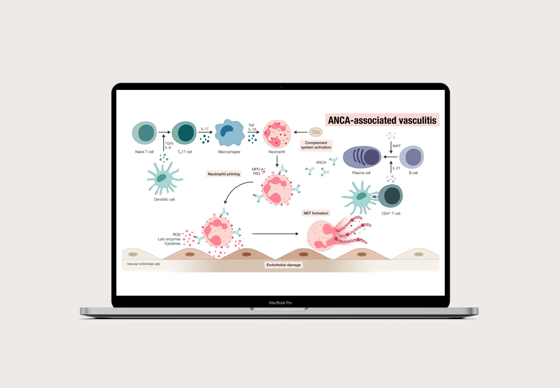 Graphical abstract summarizing the pathogenesis of ANCA-associated vasculitis.